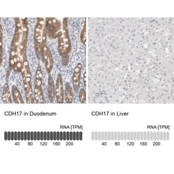 Cadherin-17 Antibody, Novus Biologicals 0.1mL; Unlabeled:Antibodies, Polyclonal